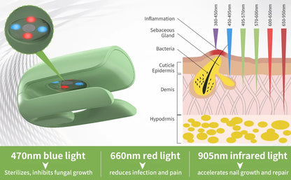 Nail Fungus Cleaning Device, Nail Fungus Cleaning Machine, Portable Nail Thickening And Decolorization Fungus Remover