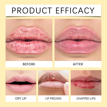 OUHOE Remove Dark Lip Balm Lightening Melanin Mask Gloss Oil Exfoliating Clean Moisturizer Korean Care Products Beauty Health